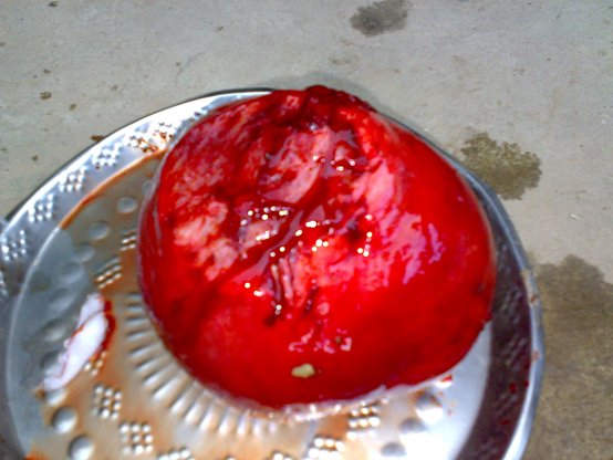 uterine cyst cow