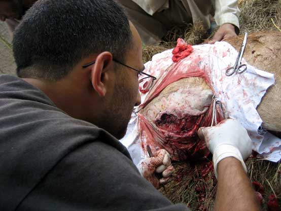 surgery on shapu