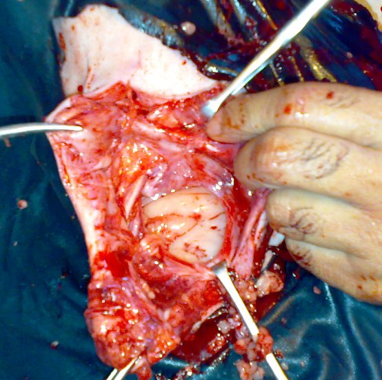 hernia_sheep_10 Hernia, herniorrhaphy, sheep, umbilical hernia, abdominal hernia