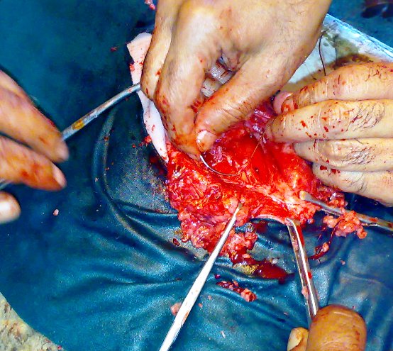 hernia_sheep_11 Hernia, herniorrhaphy, sheep, umbilical hernia, abdominal hernia