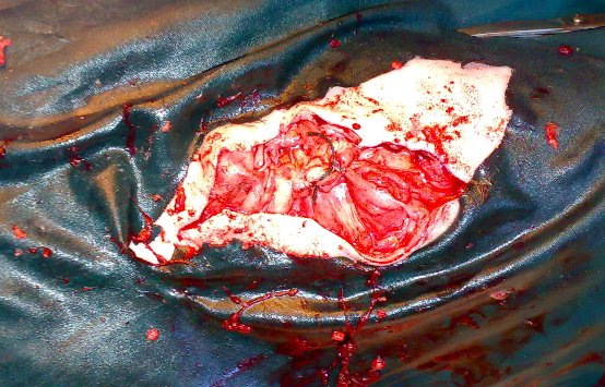 hernia_sheep_12 Hernia, herniorrhaphy, sheep, umbilical hernia, abdominal hernia