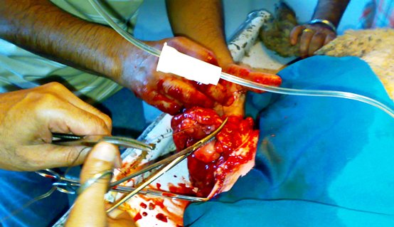 hernia_sheep_5 Hernia, herniorrhaphy, sheep, umbilical hernia, abdominal hernia