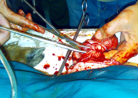 hernia_sheep_6 Hernia, herniorrhaphy, sheep, umbilical hernia, abdominal hernia