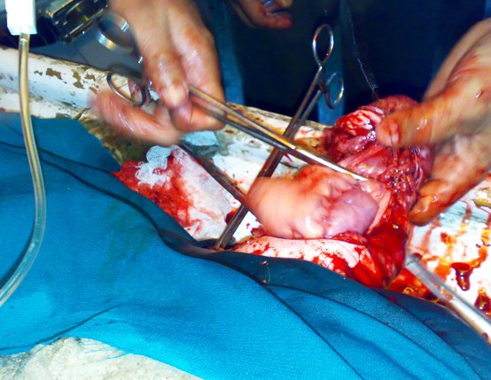 hernia_sheep_7 Hernia, herniorrhaphy, sheep, umbilical hernia, abdominal hernia