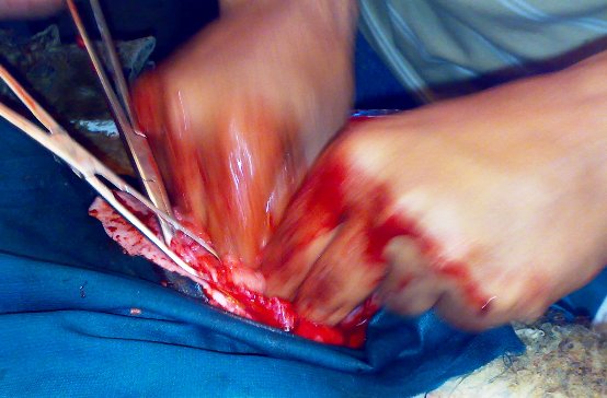 hernia_sheep_8 Hernia, herniorrhaphy, sheep, umbilical hernia, abdominal hernia