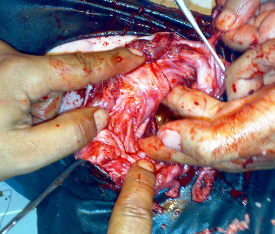 hernia_sheep_9 Hernia, herniorrhaphy, sheep, umbilical hernia, abdominal hernia