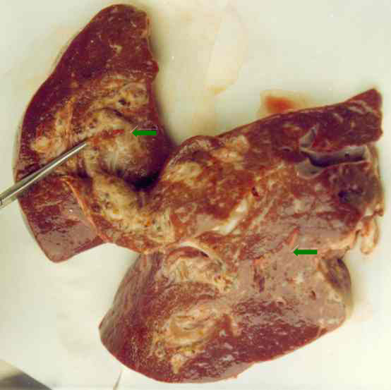 liver fluke , Fasciola hepatica liver fluke , Fasciola hepatica
